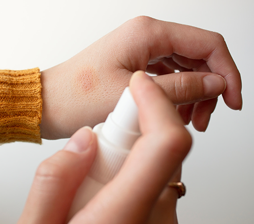 Dynarex, Hydrogen Peroxide Spray, 2 oz, Case (1169)