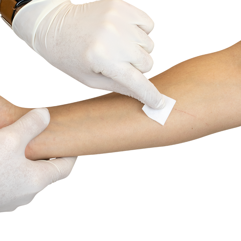 Alcohol Wipes, 10/unit, Case (1113UB-10)