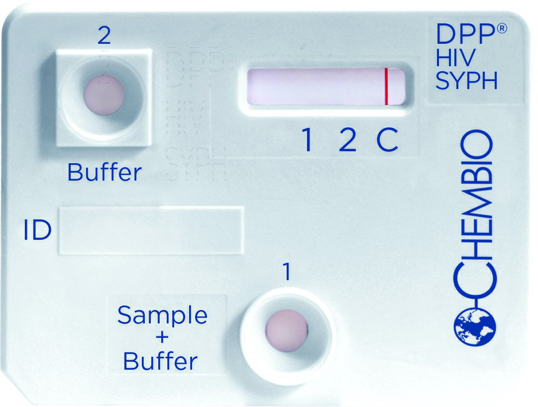 DPP HIV-Syphilis, 20 tests/kit (CDI 65-9502-0)