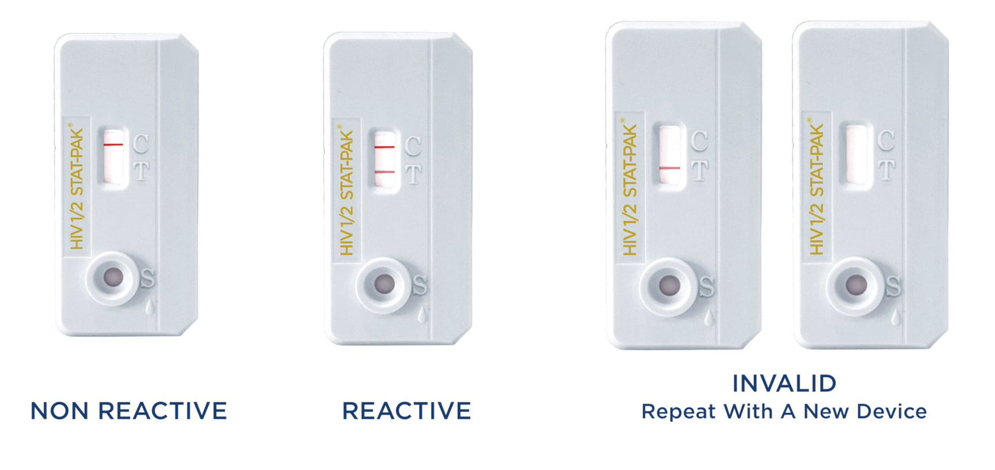 HIV 1/2 STAT-PAK Assay, 20 tests/kit (CDI 60-9505-1)