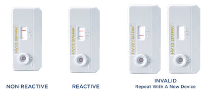 HIV 1/2 STAT-PAK Assay, 20 tests/kit (CDI 60-9505-1)